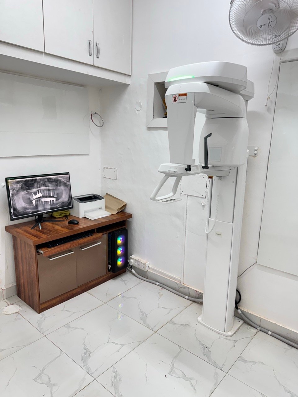 In-house OPG X-ray machine showing a panoramic dental scan at Mezan Dental Perfections